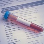 https://www.pexels.com/it-it/foto/provetta-per-campione-di-sangue-su-pannello-di-analisi-chimiche-39190202/