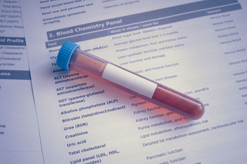 https://www.pexels.com/it-it/foto/provetta-per-campione-di-sangue-su-pannello-di-analisi-chimiche-39190202/